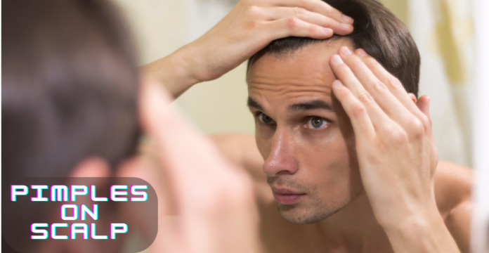 Pimples on scalp